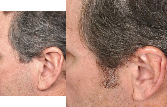 Before /after with Help hair Shake for gray hair